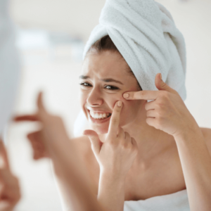 Read more about the article Akne – Hipoklorova kislina za naravni boj proti aknam